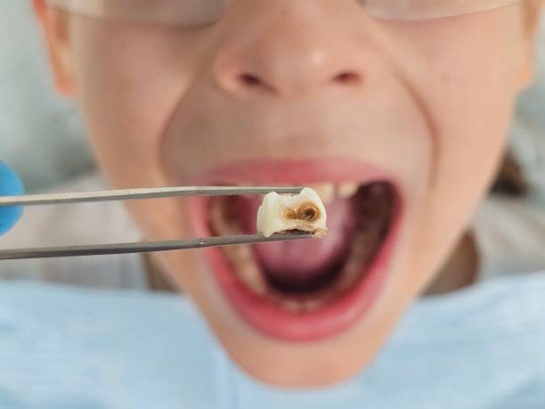 Professional Emergency Dental Service in CA