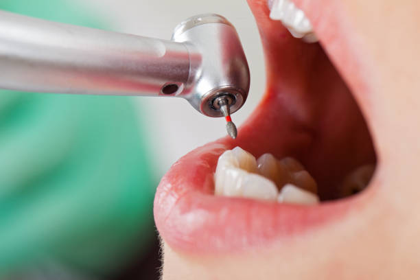 Best Emergency Care for Gum Disease in Eastern Goleta Valley, CA